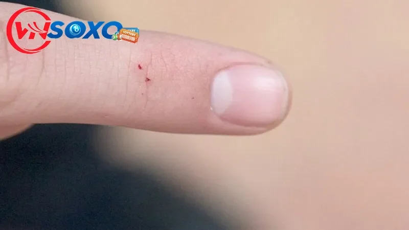 Ý nghĩa về ngủ mơ thấy rắn cắn gây chết người Ý nghĩa về ngủ mơ thấy rắn cắn gây chết người